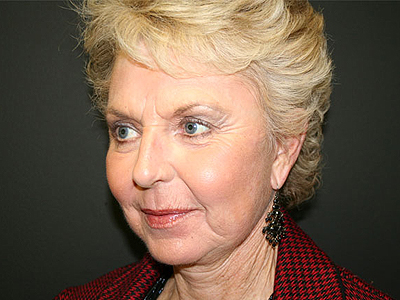 Facelift Before & After Image