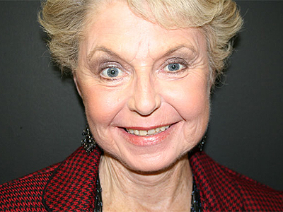 Facelift Before & After Image