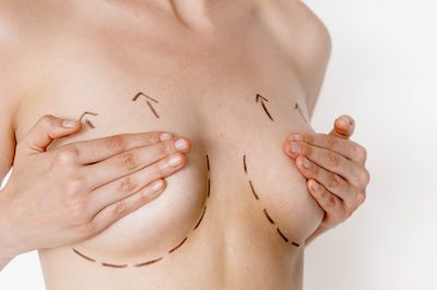 breast lift procedure houston
