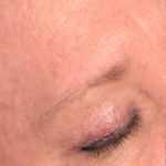 Eyeliner Permanent Makeup Before & After Patient #7107