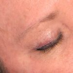 Eyeliner Permanent Makeup Before & After Patient #7111