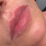 Lip Blushing Permanent Makeup Before & After Patient #7134