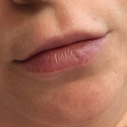 Lip Blushing Permanent Makeup Before & After Patient #7137