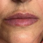 Lip Blushing Permanent Makeup Before & After Patient #7138