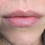 Lip Blushing Permanent Makeup Before & After Patient #7142
