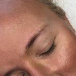 Microblading Permanent Makeup Before & After Patient #7284