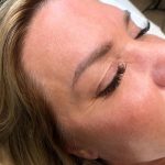 Microblading Permanent Makeup Before & After Patient #7329