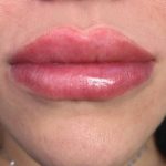 Lip Blushing Permanent Makeup Before & After Patient #7142