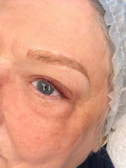 Microblading Permanent Makeup Before & After Patient #7314