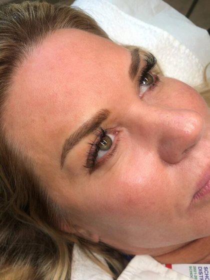 Microblading Permanent Makeup Before & After Patient #7343