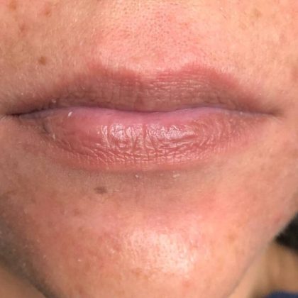 Lip Blushing Permanent Makeup Before & After Patient #7141