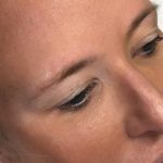 Microblading Permanent Makeup Before & After Patient #7284