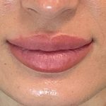 Lip Blushing Permanent Makeup Before & After Patient #7136