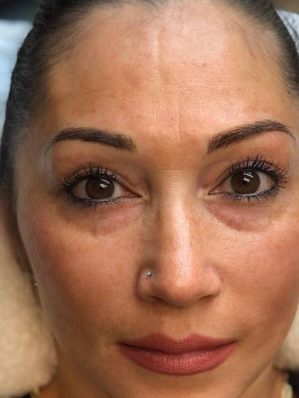 Microblading Permanent Makeup Before & After Patient #7286